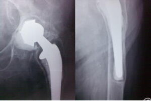 quadro radiografico
