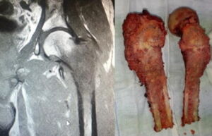 Immagine RMN e pezzo anatomico.