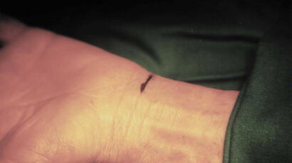 incisione da 1cm