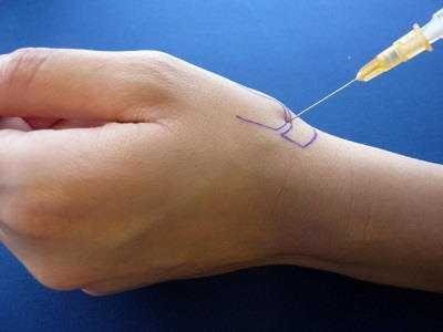 terapia per iniezione