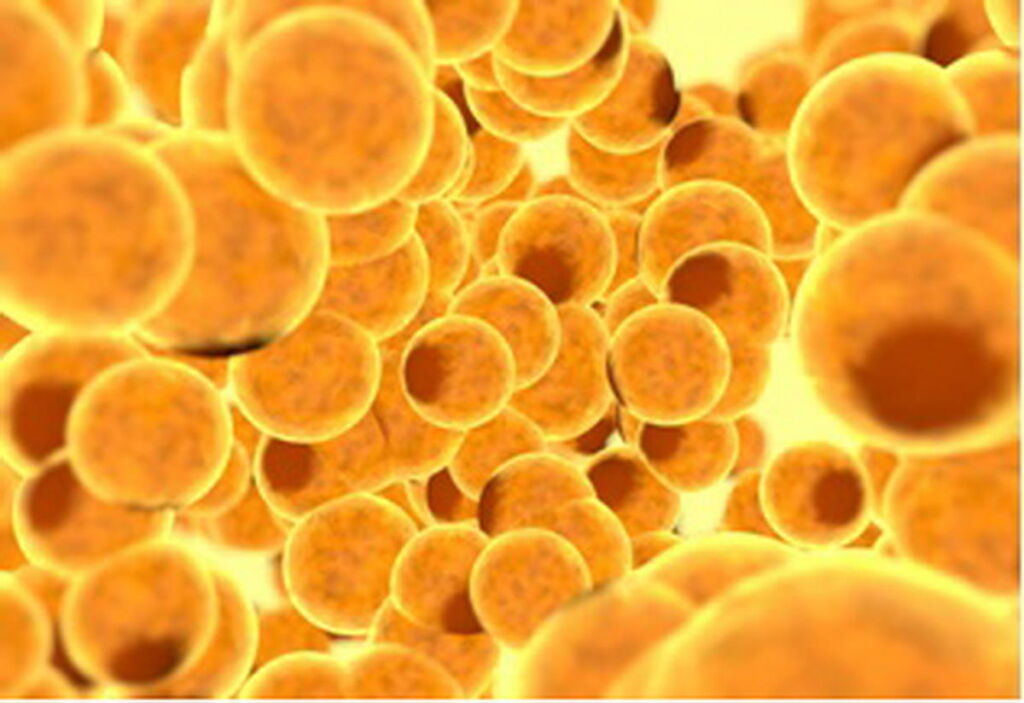 cellule lipogems