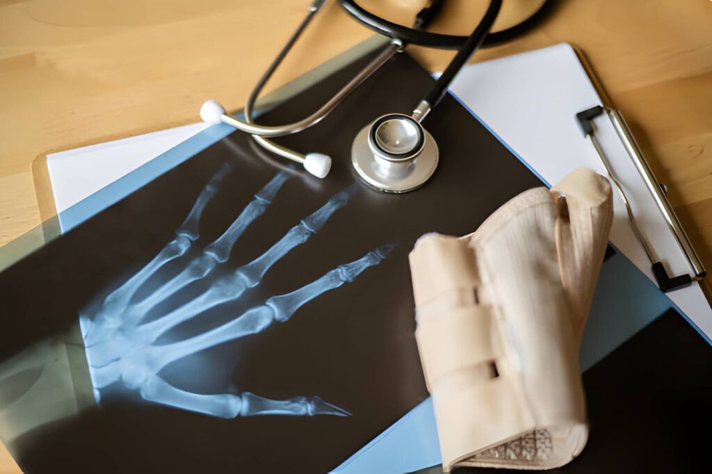 radiografia mano e polso