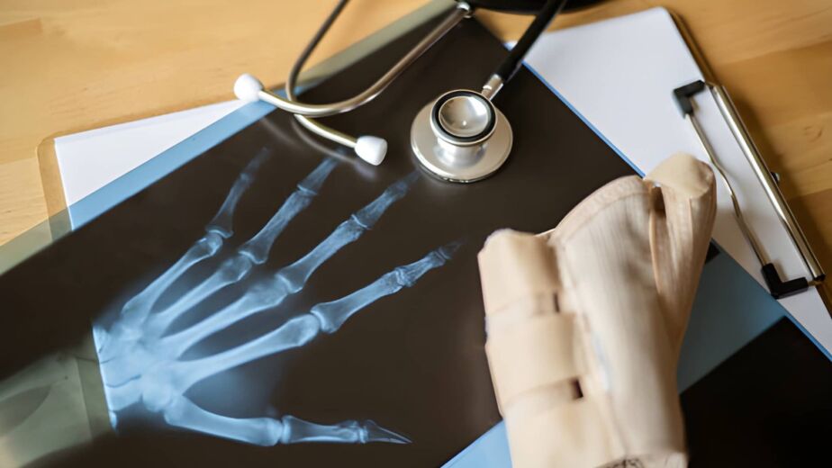 radiografia mano e polso