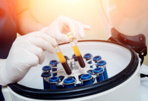 centrifuga plasma