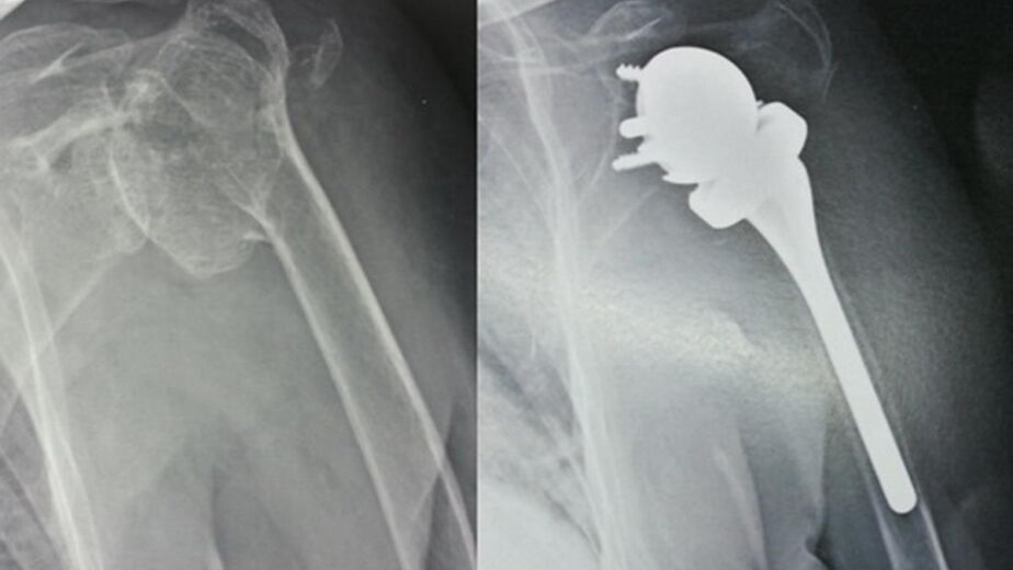 radiografia per e post intervento