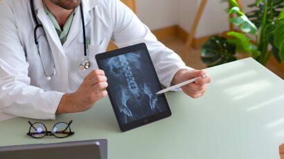 patologi dell'anca - radiografia