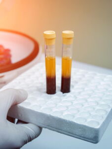 provette di plasma - pappa piastrinica