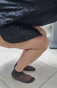 caso 3 protesi ginocchio