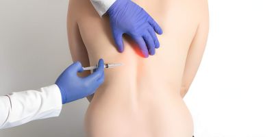 iniezione ozonoterapia