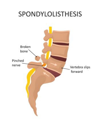 steptodown.com349880